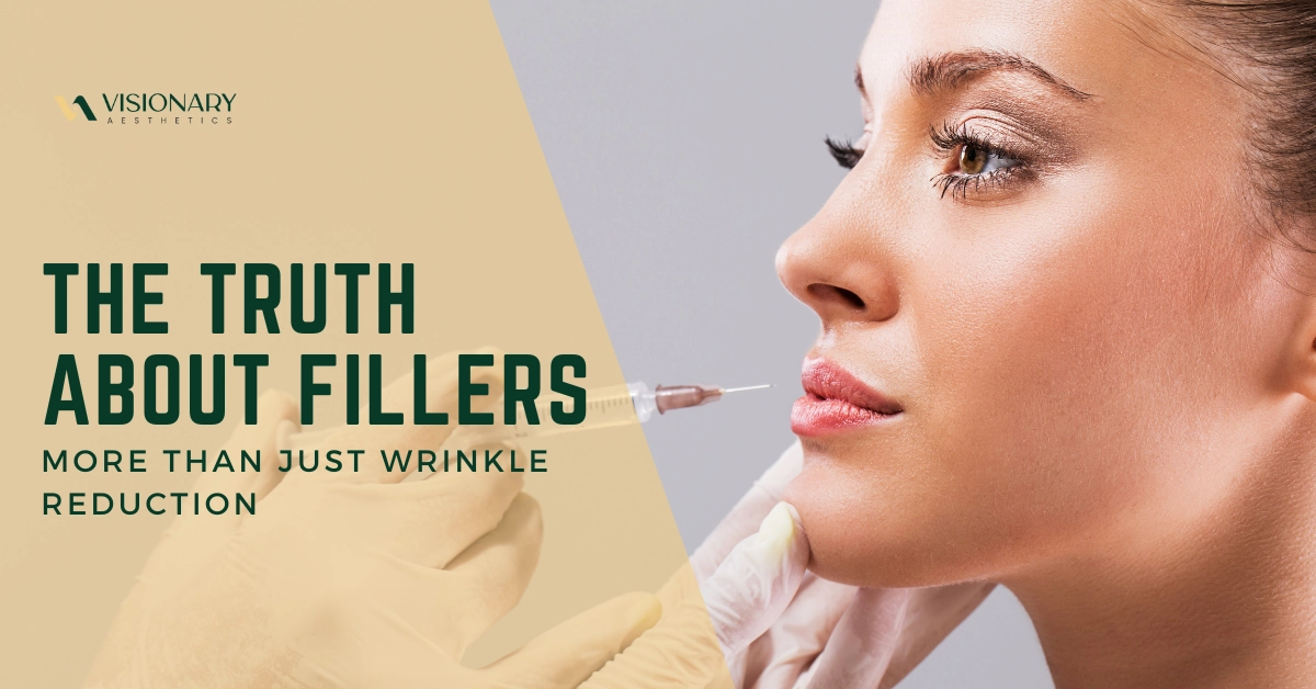 The Truth About Fillers: More Than Just Wrinkle Reduction